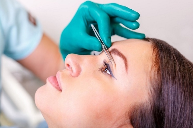 Cắt mí và những điều cần lưu ý trước khi cắt mí 3