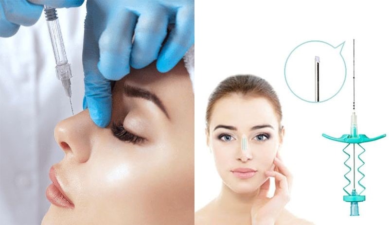 Nâng mũi giữ được bao lâu? Bí quyết chăm sóc mũi bền và đẹp 3