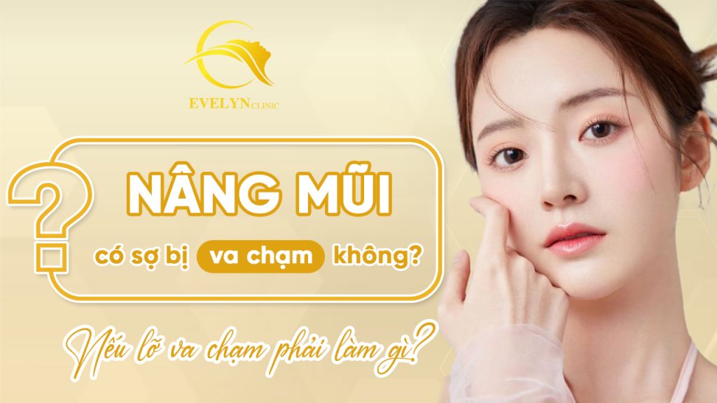 Nâng mũi có sợ bị va chạm không? Nếu lỡ va chạm phải làm gì? 1