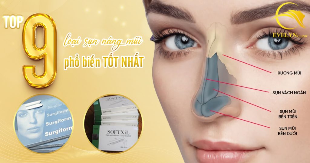 TOP 9 Loại Sụn Nâng Mũi Phổ Biến TỐT NHẤT Hiện Nay 1